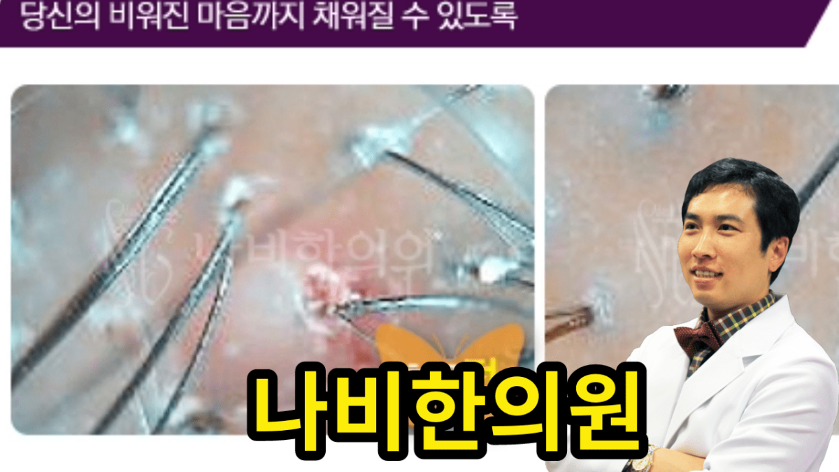 두피 모낭염 사진