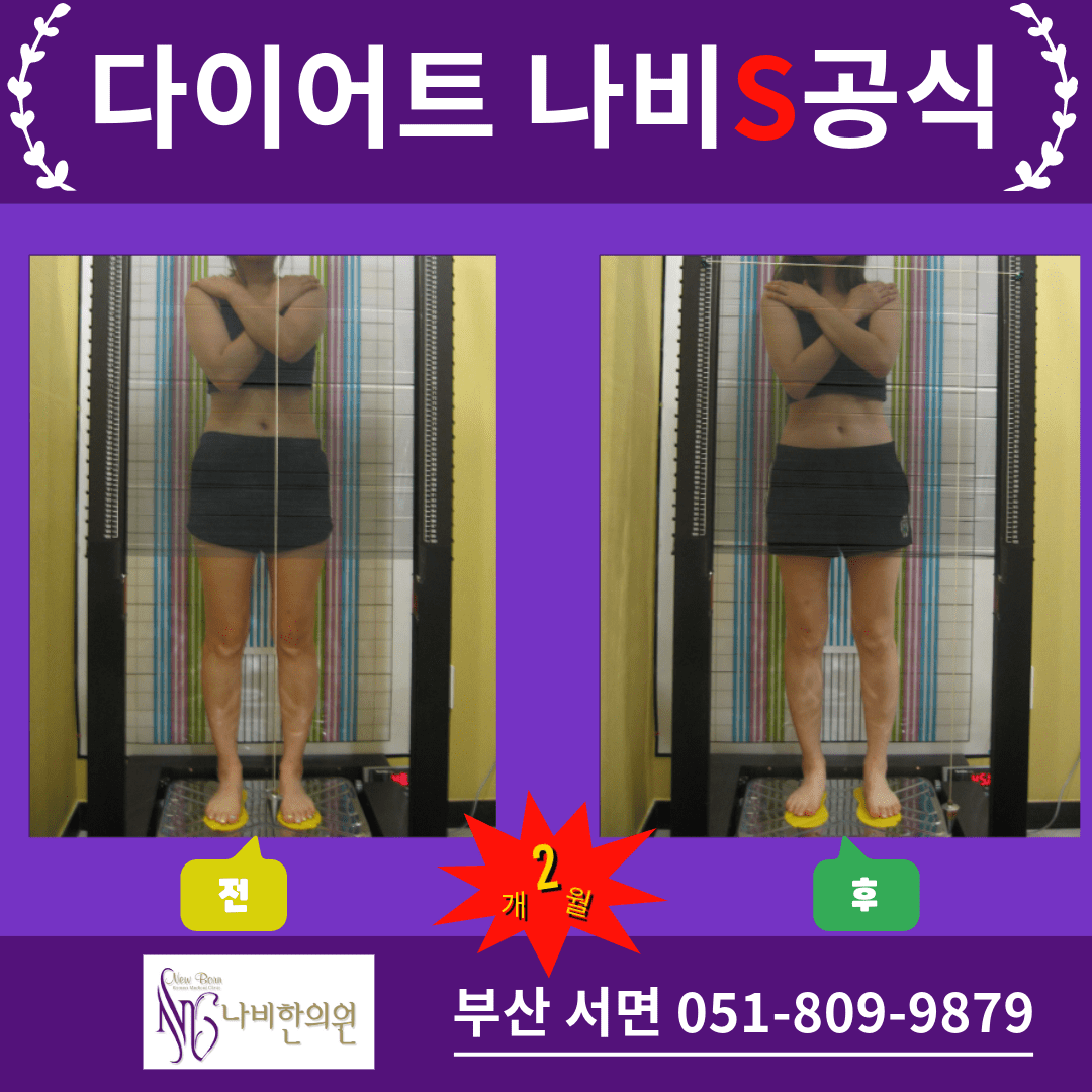 부산 다이어트 음식