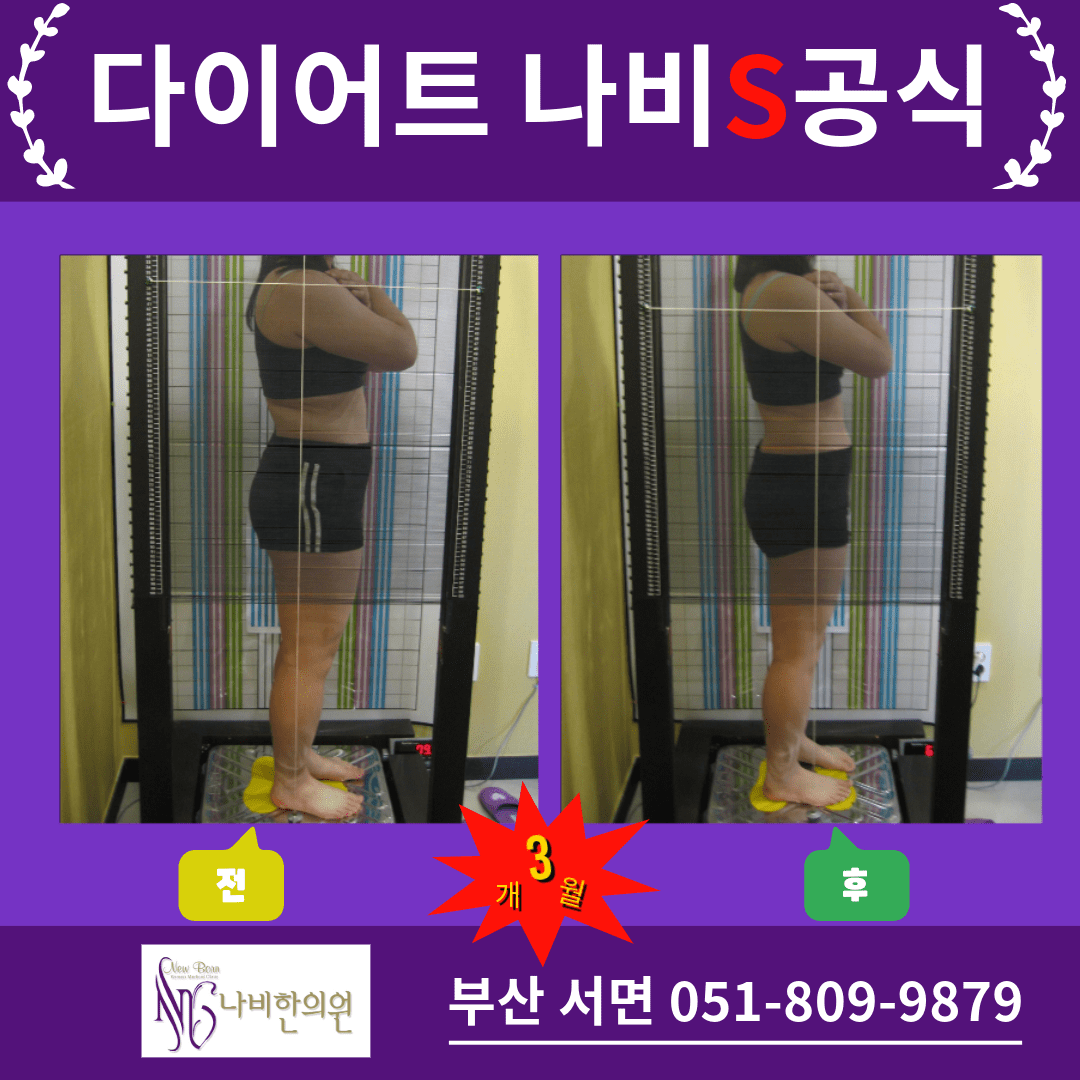 다이어트