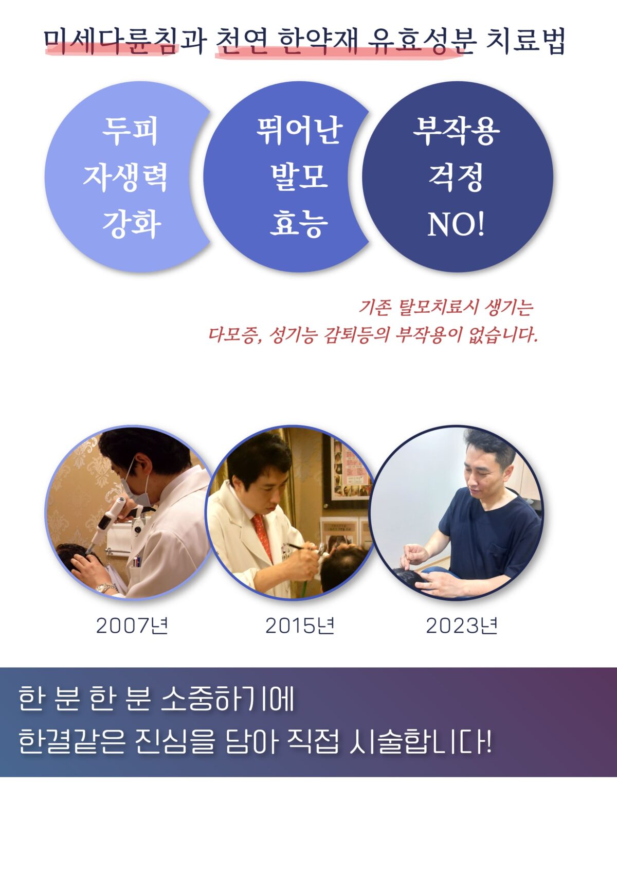 여성탈모병원