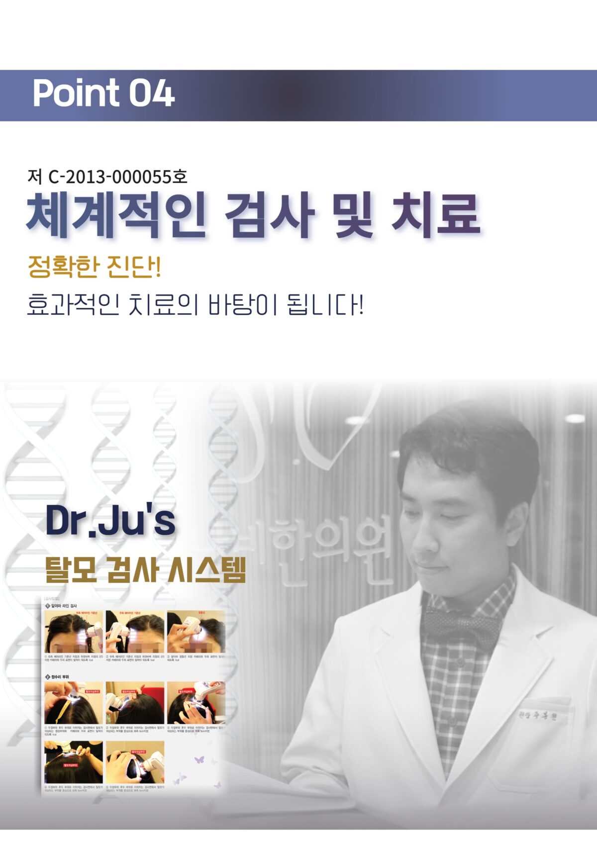 여자탈모