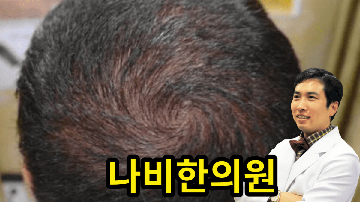 두피 모낭염