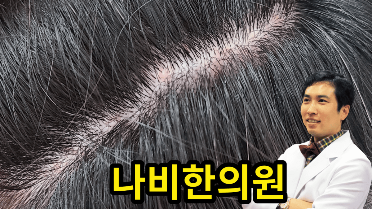 두피 모낭염