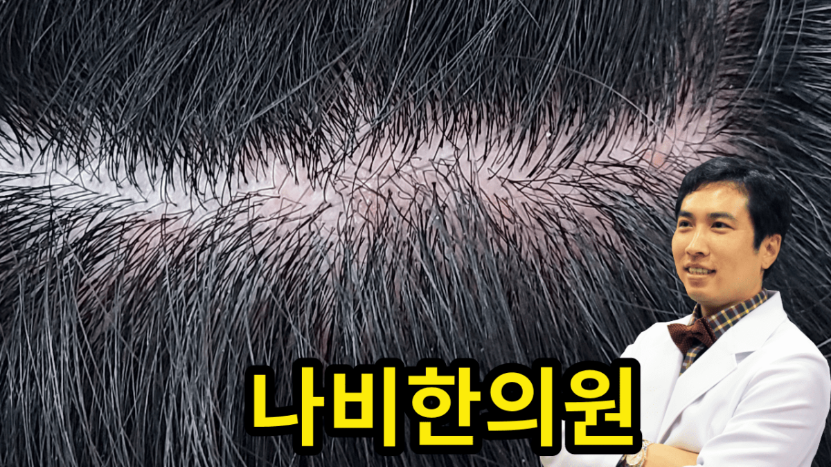 두피 모낭염