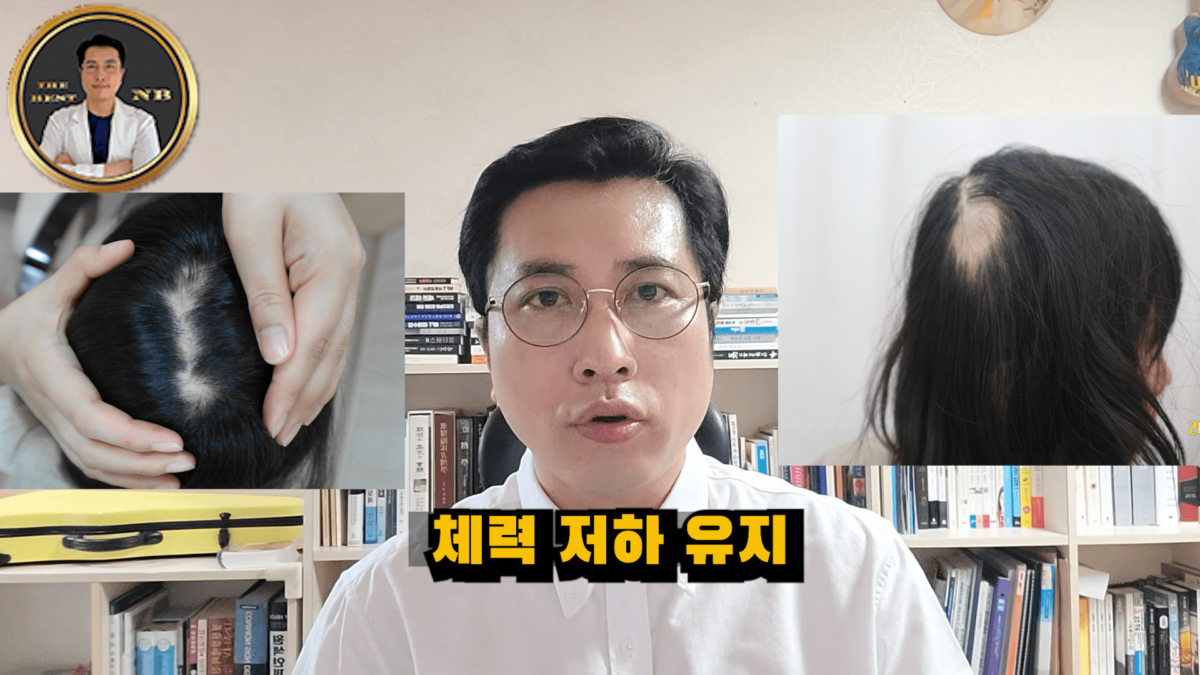 원형탈모