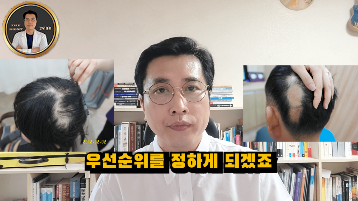 원형탈모