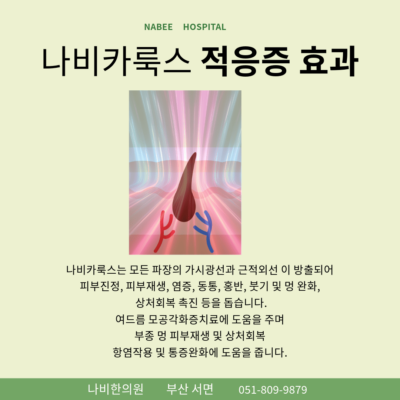 탈모자가진단