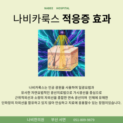 M자 탈모 초기