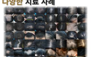 부산탈모병원